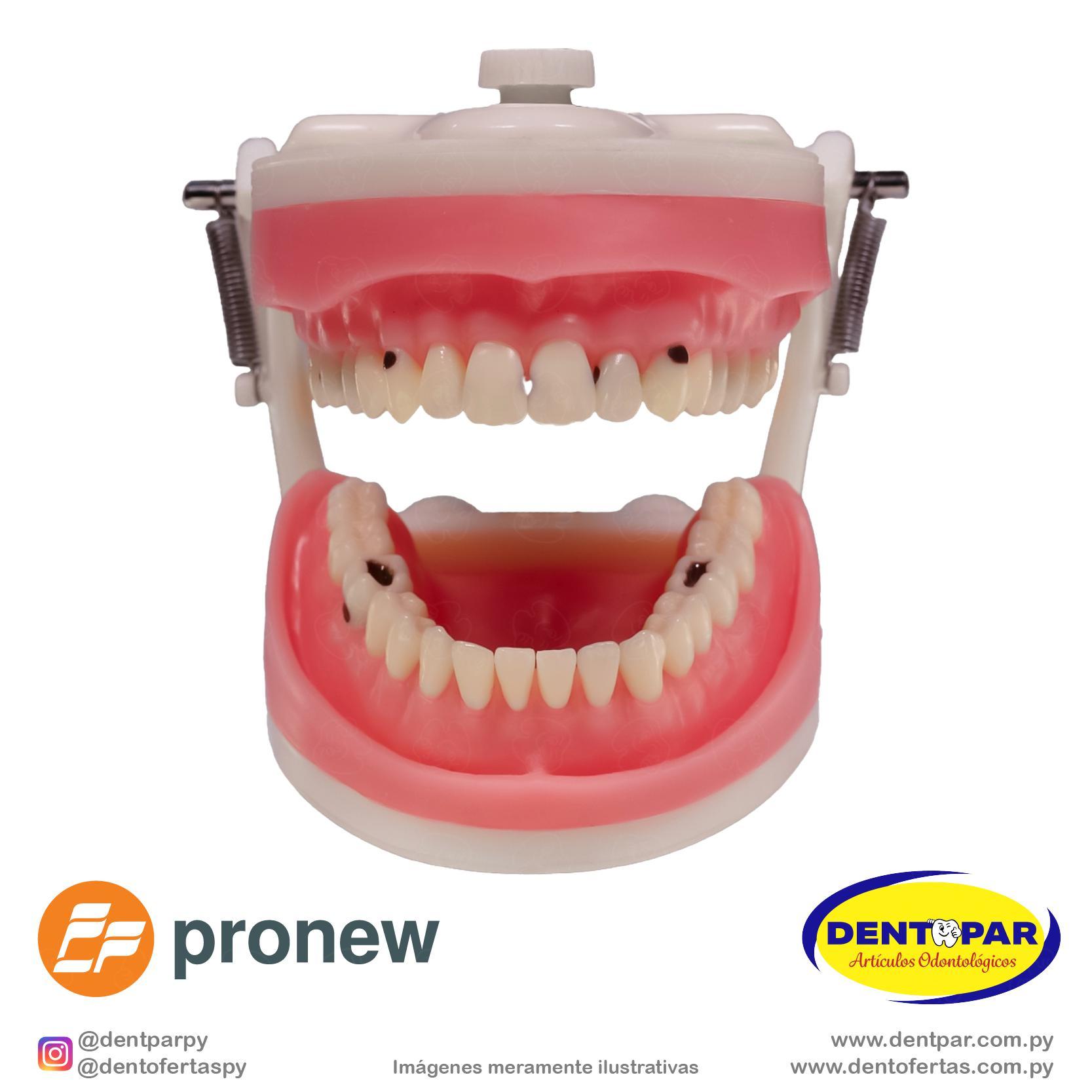 Imagen del producto Juego de Dientes Cariados C/11